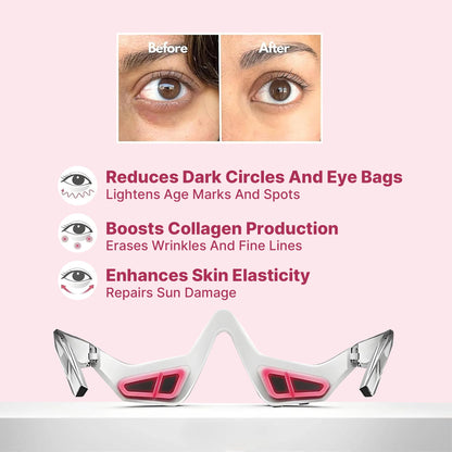 EMS Eye Red Light Eye Massager – Reduce Wrinkles & Relax Your Eyes