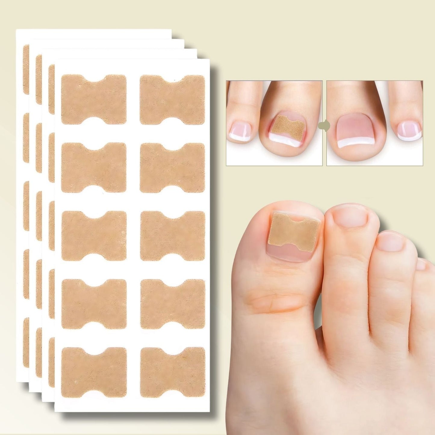 Fungi Nail Patches – Fast Relief from Ingrown Nails & Nail Fungus (10-Pack)