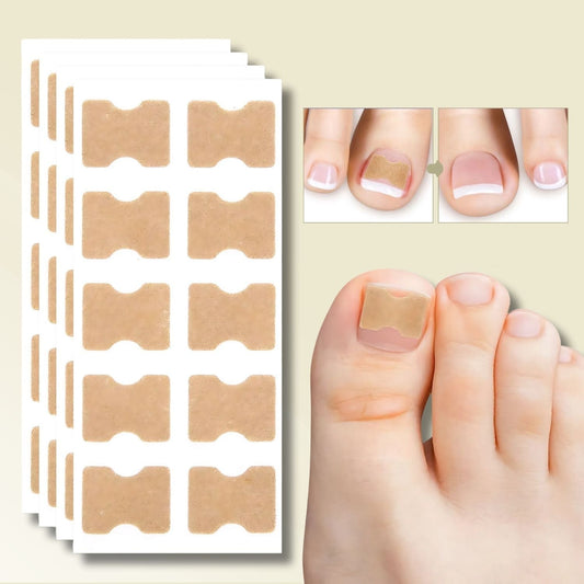 Fungi Nail Patches – Fast Relief from Ingrown Nails & Nail Fungus (10-Pack)